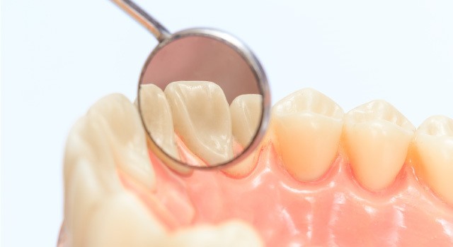 dentures